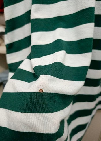 Çizgili Elbise, Uzun Kollu, Salaş - Görsel 4