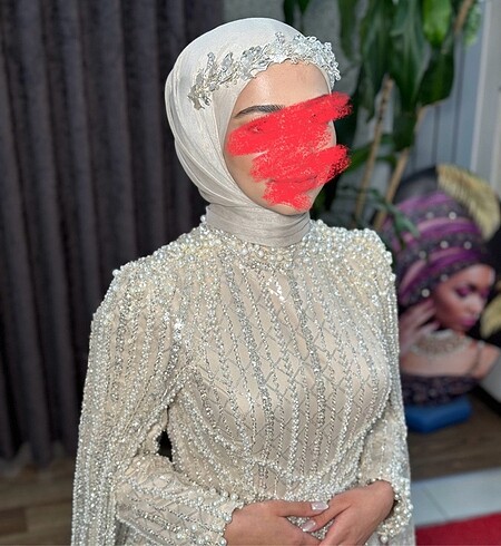 Alınlık aksesuar
