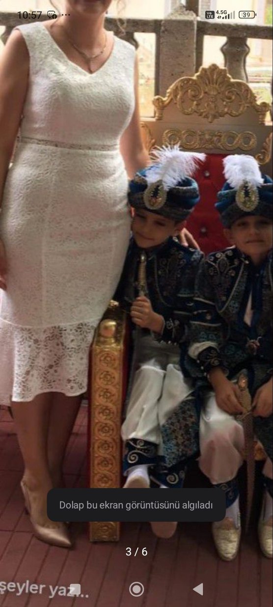 Beyaz Dantel Detaylı Midi V Yaka Elbise - Görsel 3