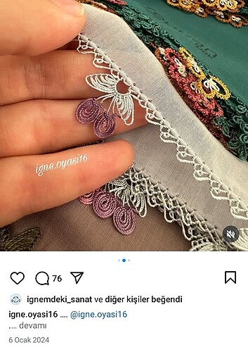 İğne oyasi