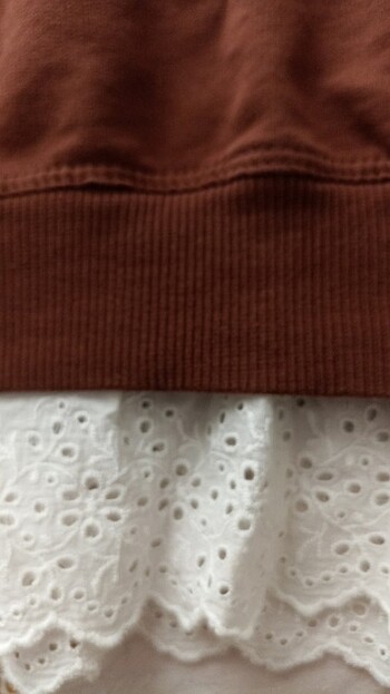 xl Beden Dantelli Tunik