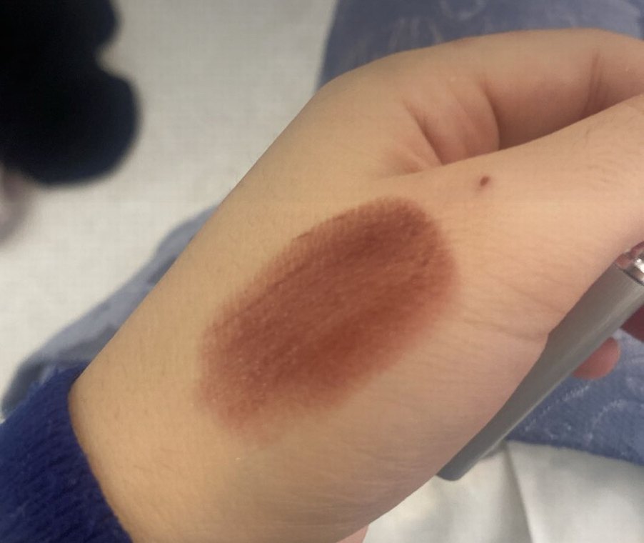 Black honey - Görsel 3