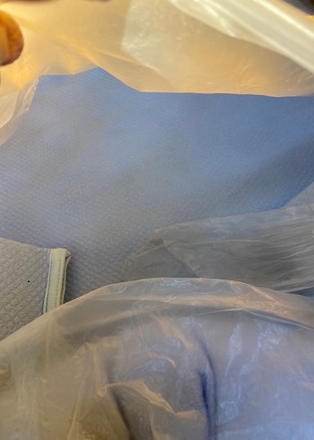 Reflü yatağı - Görsel 2