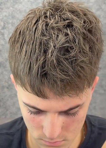 Mucizevi Tarak - Görsel 6