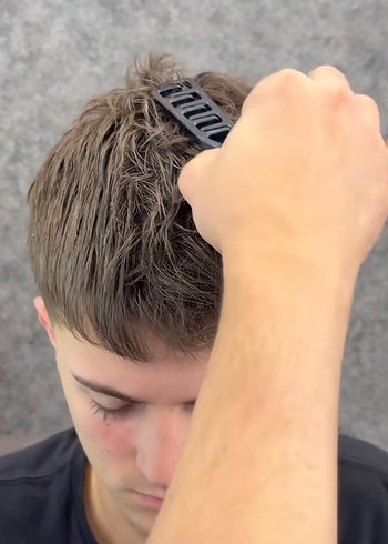 Mucizevi Tarak - Görsel 5