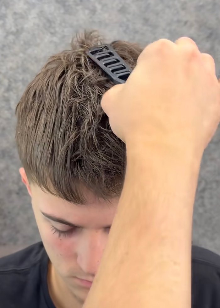 Mucizevi Tarak - Görsel 5