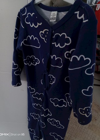 Mavi Bulut Desenli Erkek Bebek Tulum bir buçuk yaşa kadar olur - Görsel 4