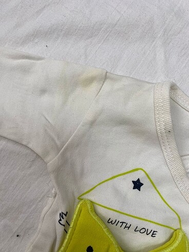 Yenidoğan - Görsel 3