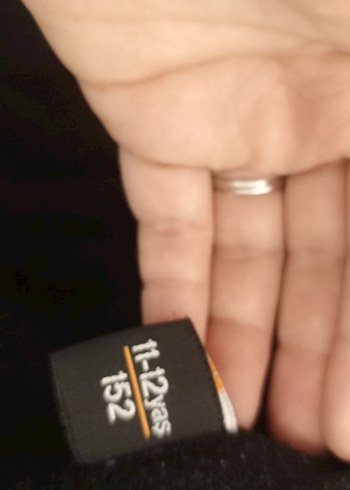 kolunda küçük defosu var - Görsel 5