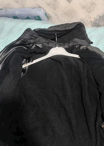 kolunda küçük defosu var - Görsel 4