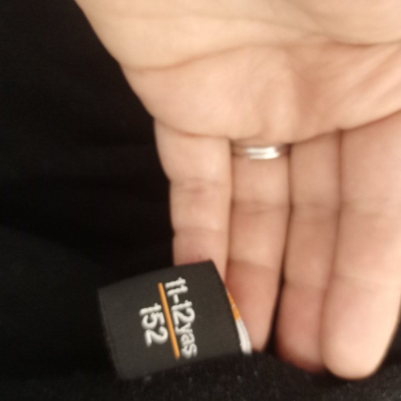 kolunda küçük defosu var - Görsel 5