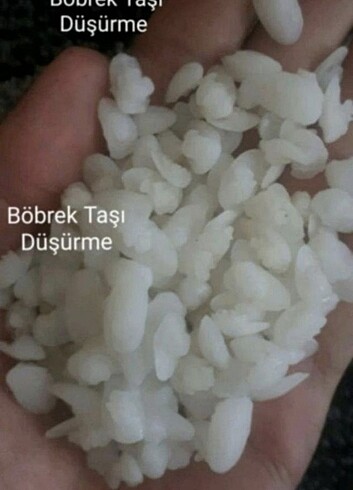 Böbrek Taşına Doğal Çözüm 