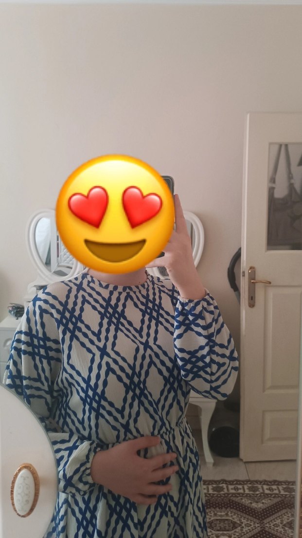 Mavi Desenli Elbise - Görsel 3