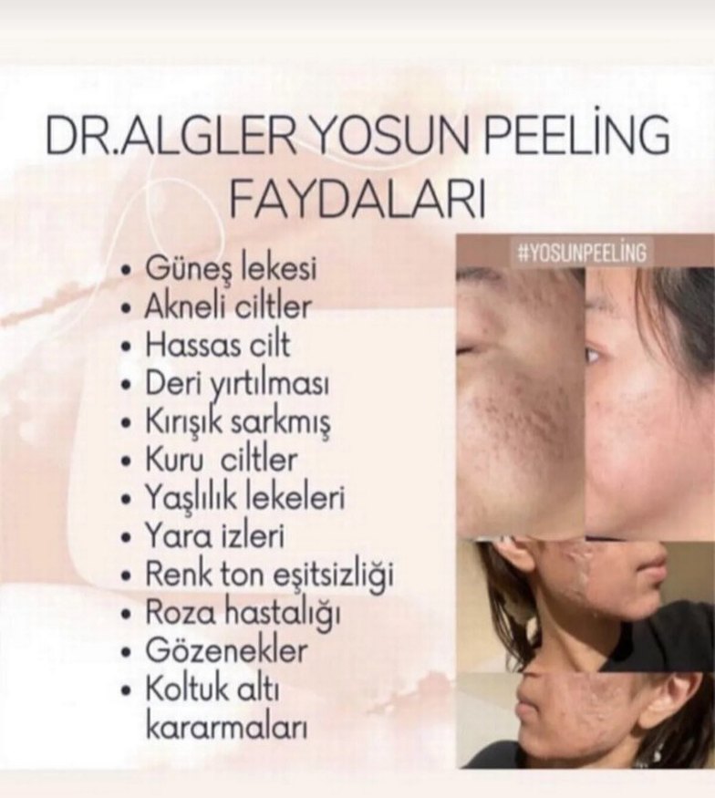 Dr.Algler Mor Bitkisel  yosun Peeling Seti - Görsel 2