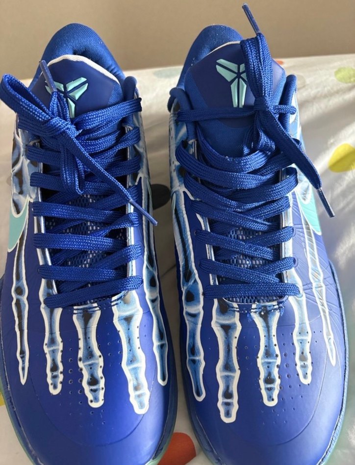 Kobe 5 x-ray - Görsel 2