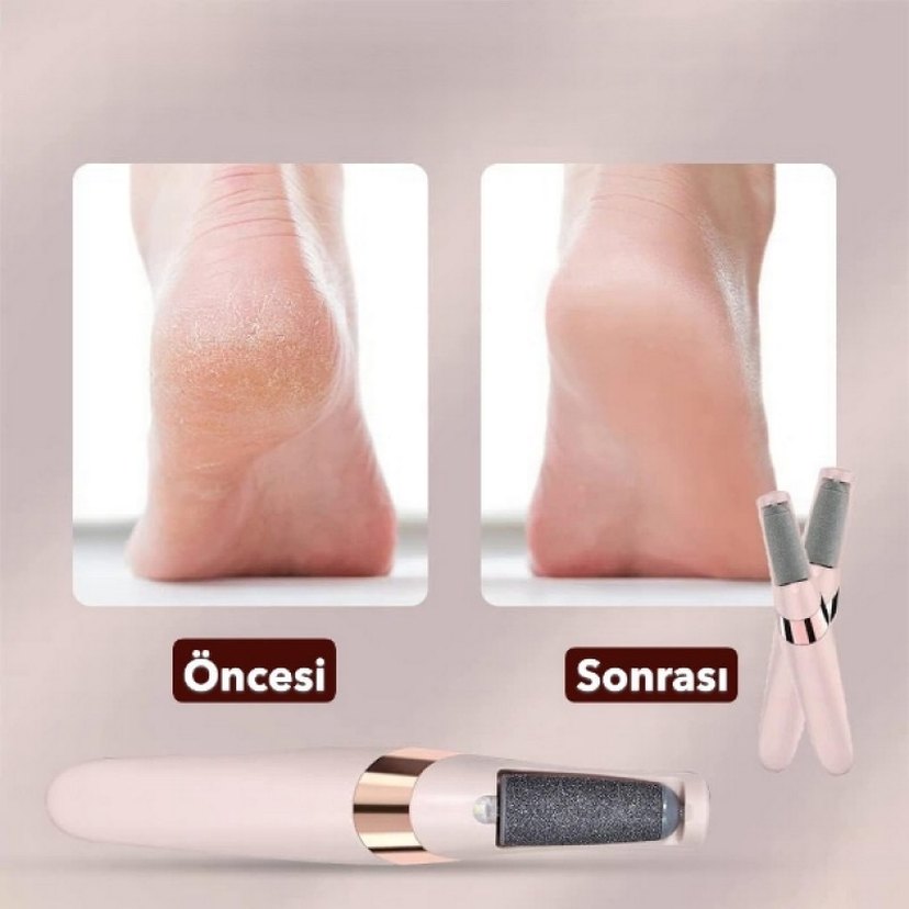 Şarzlı Ayak ve Topuk Bakım Aleti - Görsel 3