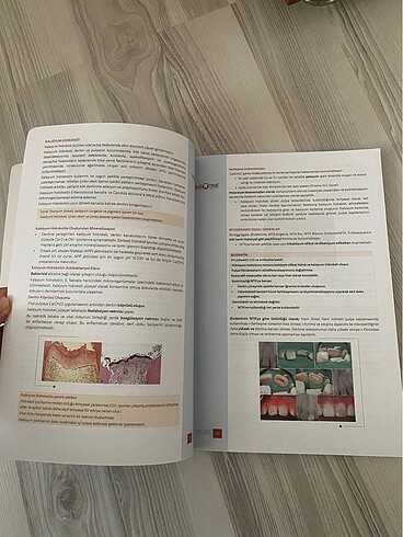 Beden Renk Dustime endodonti