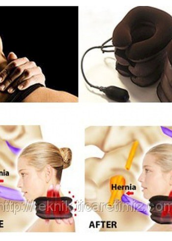 Ortapedik Şişirilebilir Boyun Destek Yastığı - Görsel 3