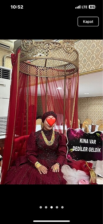 Diğer Kınalık