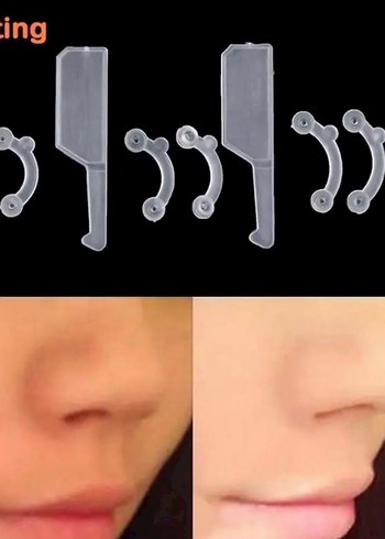 Görünmez Burun Destek Aparatı - Görsel 7