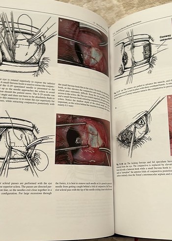Beden Color Atlas of Strabismus Surgery - 4. Baskı