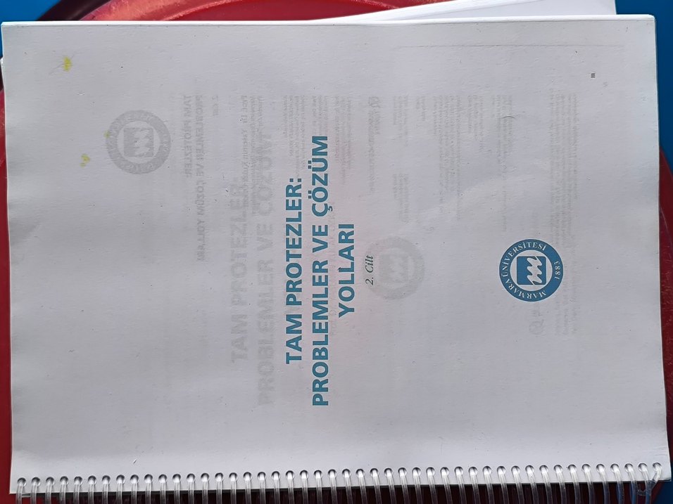 Tam Protezler: Problemler ve Çözüm Yolları - Görsel 2