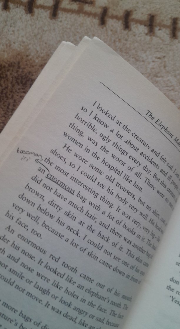 The Elephant Man - Tim Vicary - Görsel 5