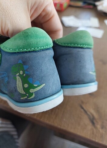 Ortopedik deri sandalet - Görsel 10