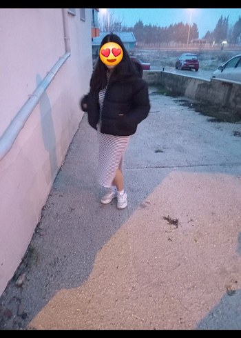 Düğmeli V Yakalı Çizgili elbise - Görsel 3