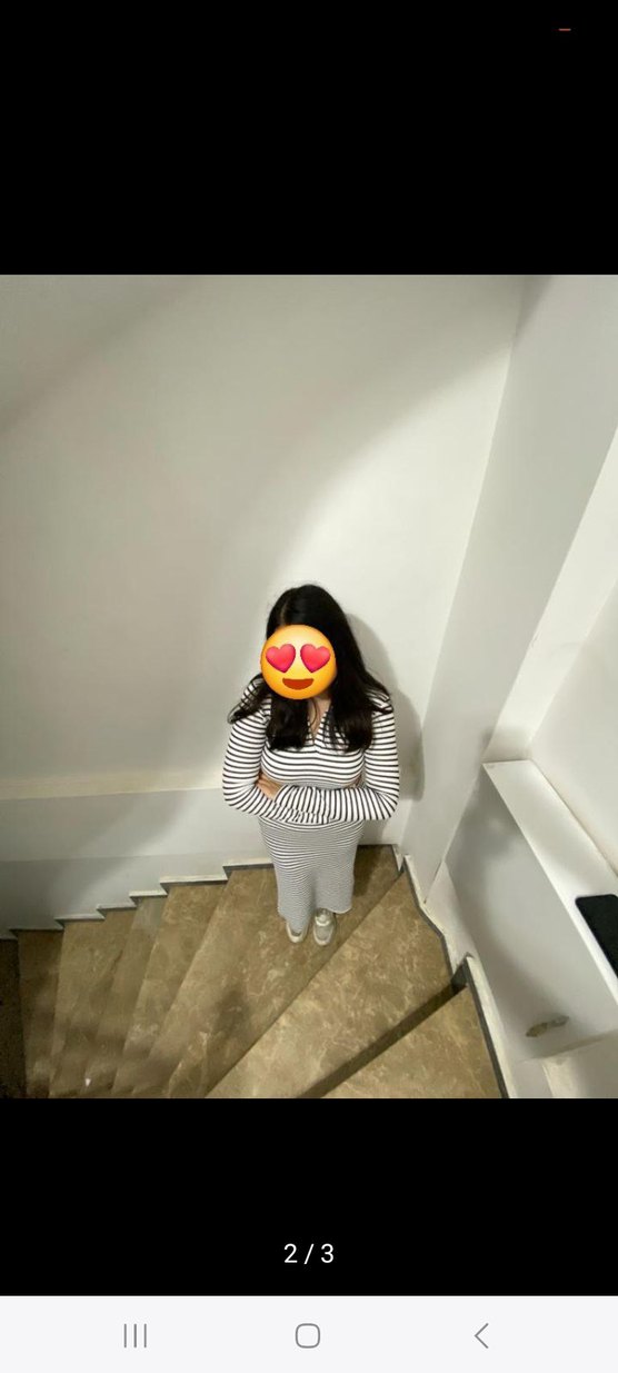 Düğmeli V Yakalı Çizgili elbise - Görsel 2