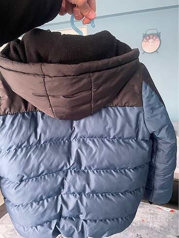 Mont şişme - Görsel 5