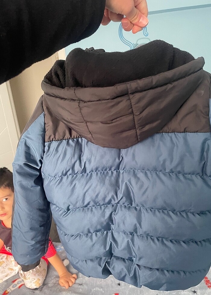 Mont şişme - Görsel 4