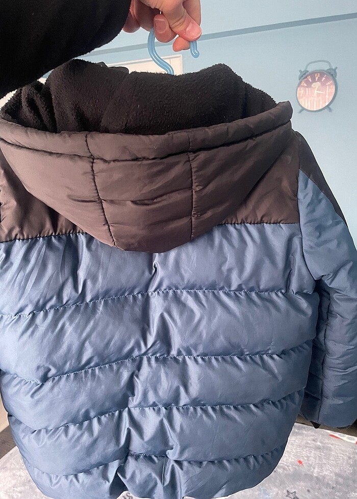 Mont şişme - Görsel 5