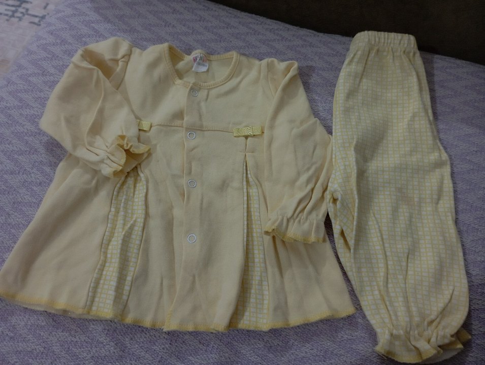 Sarı Düğmeli Bebek Kız Takımı - Görsel 2