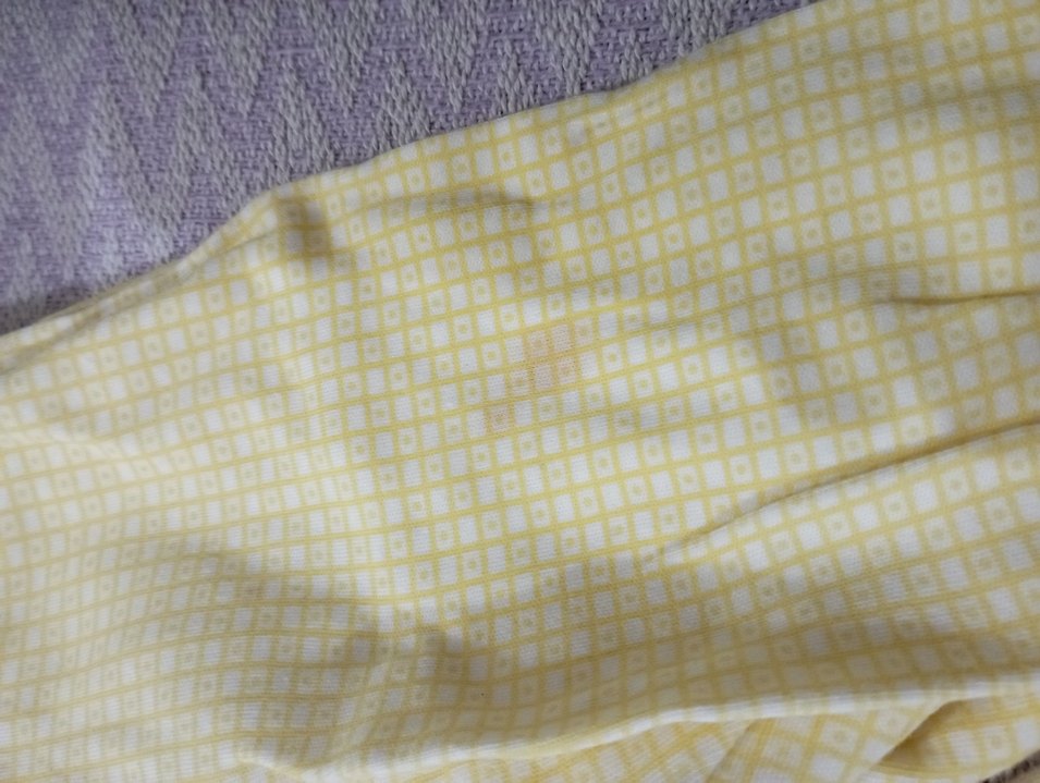 Sarı Düğmeli Bebek Kız Takımı - Görsel 3