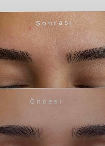 Kaş & Kirpik Bakım Serumu - Görsel 6