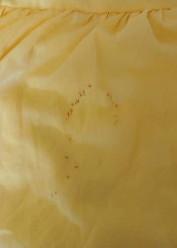 Sarı Kolsuz Midi Keten Elbise - Görsel 11