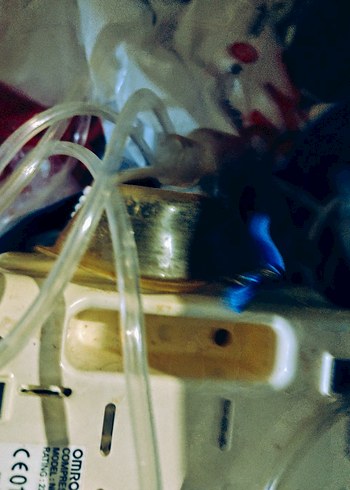 compressor nebuliser