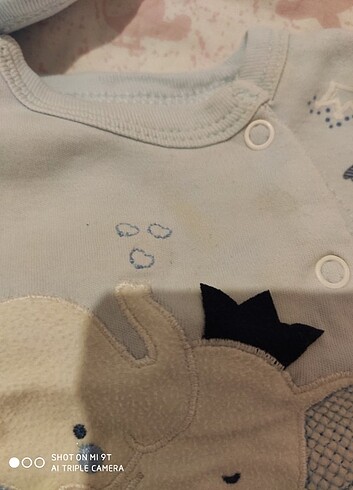 5 parça hastane çıkışı - Görsel 3