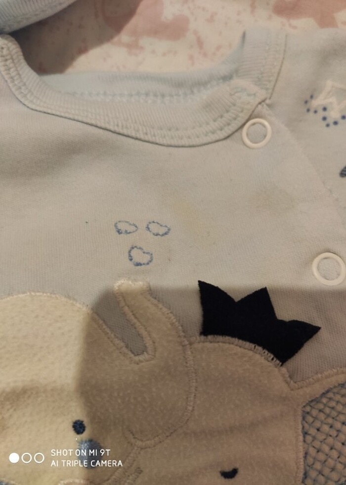 5 parça hastane çıkışı  - Görsel 3