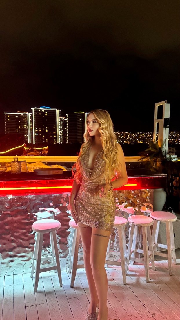 Zara model elbise - Görsel 2