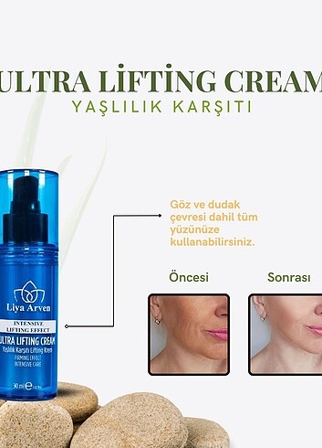  Beden Yaşlanma karşıtı Niacinamide Lifting Krem 30 ml