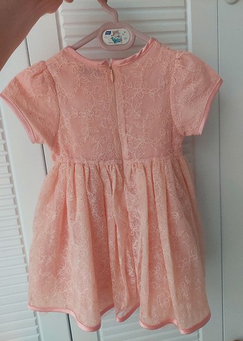 Kız Çocuk Pembe Dantelli Elbise - Görsel 2