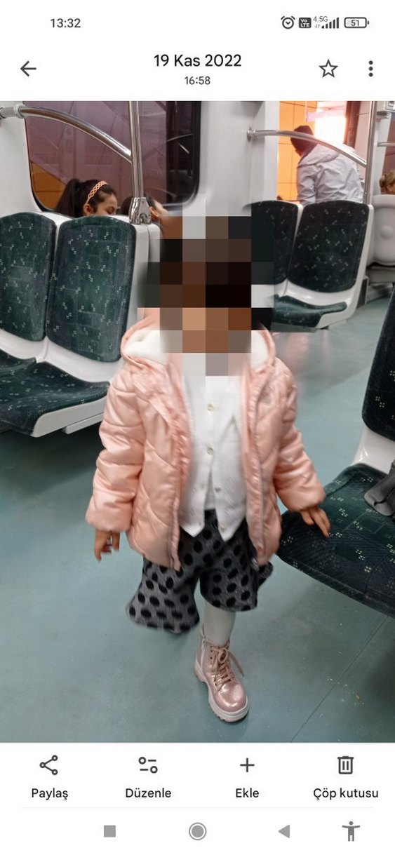 takım Kız Çocuk somon mont rengi Puantiyeli etek - Görsel 2