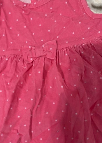 Kız Çocuk Pembe Puantiyeli Elbise - Görsel 2