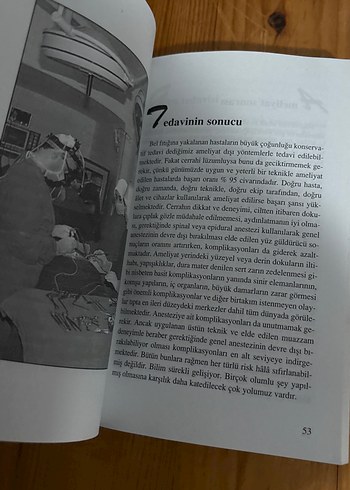 Bel fıtığı - Görsel 2