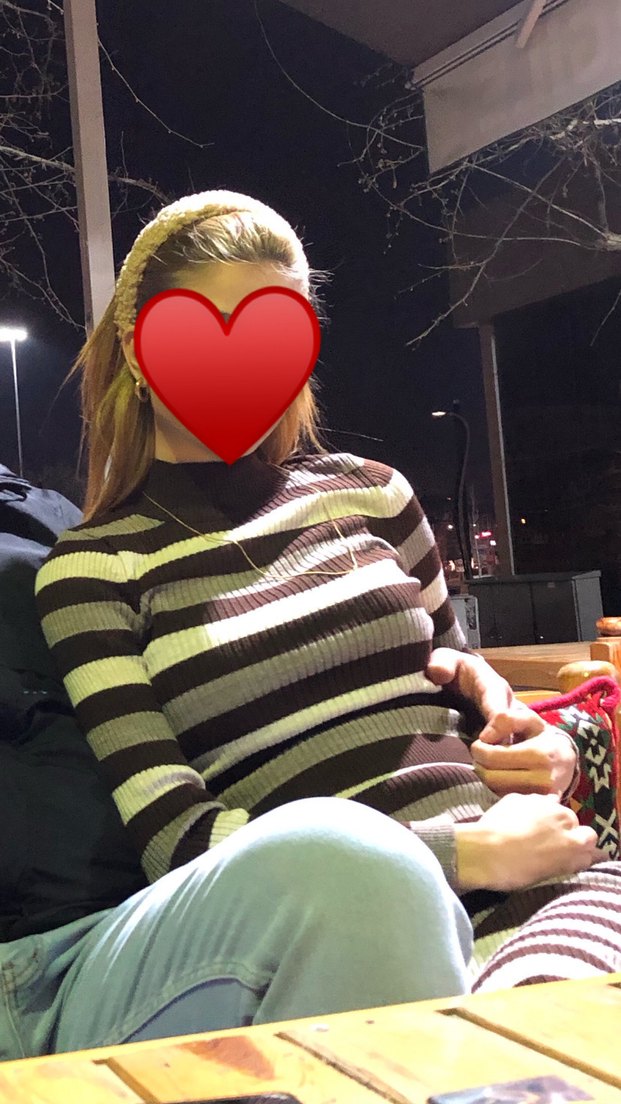 Siyah Zebra Desenli Hamile Midi Elbise - Görsel 2