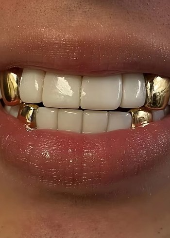 UNISEX GRILZZ - Görsel 3