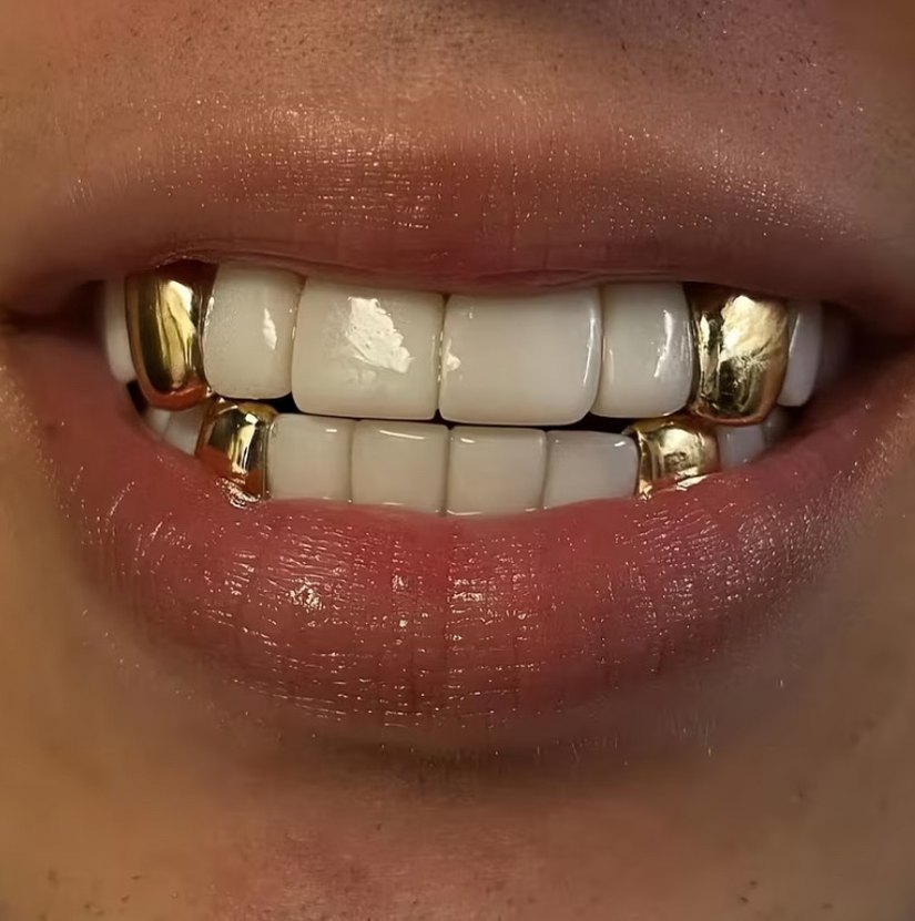 UNISEX GRILZZ - Görsel 3