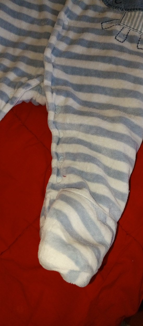 Kapüşonlu Gri Desenli Bebek Tulumu - Görsel 5